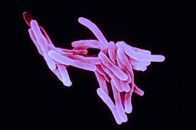 Mycobacterium_tuberculosis_04