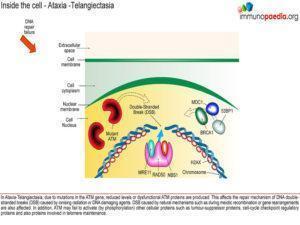 Ataxia-telangiectasia_Page_4.1