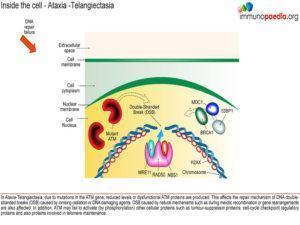 Ataxia-telangiectasia_Page_4.1