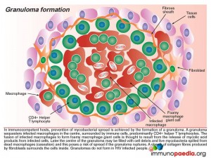 Granuloma formation