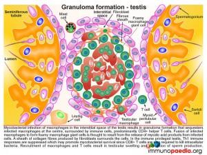 Granuloma formation-testis