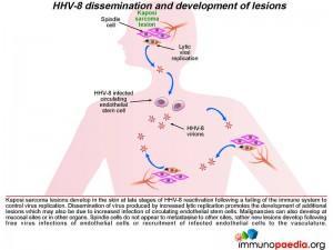 HHV-8 dissemination and development of lesions
