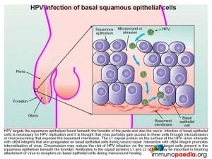 HPV infection of basal squamous epithelial cells