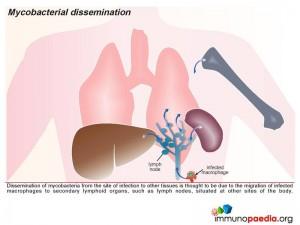 Mycobacterial dissemination