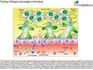 Post-streptococcal glomerular-nephritis_Page_06.1