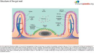 Ulcerative colitis_Page_1