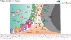 Ulcerative colitis_Page_2