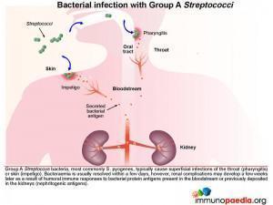 Bacterial Infection with group A Streptococci