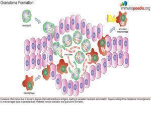 chronic granulomatous disease_Page_2.1