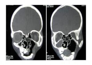 CT scan