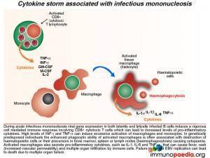 Cytokine storm associated with infectious mononucleosis