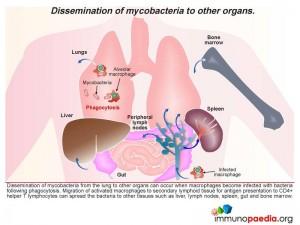 Dissemination of mycobacteria to other organs