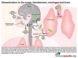 Dissemination to the lungs bloodstream meninges and brain