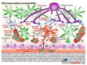 HIV associated encephalitis