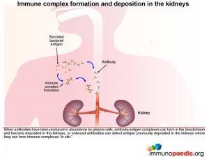 Immune complex formation and deposition in the kidneys