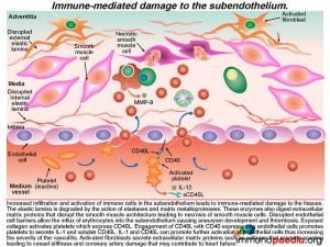 Immune mediated damage to-the subendothelium