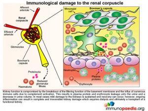 Immunological damage to the renal corpuscle