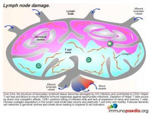 Lymph node damage