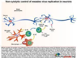 non-cytolytic-control-of-measles-virus-replication-in-neurons