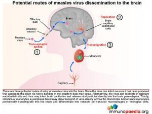 potential-routes-of-measles-virus-dissemination-to-the-brain