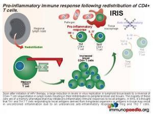 Pro-inflammatory immune response following redistribution of CD4 T cells