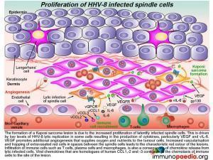 Proliferation of HHV-8 infected spindle cells