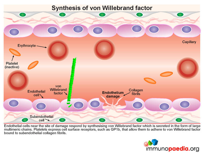 Thrombotic Thrombocytopaenic Purpura Case Study Immunopaedia Immunopaedia