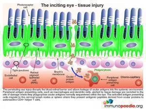 The inciting eye tissue injury