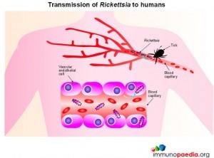 Transmission of Rickettsia to humans