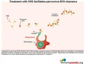 Treatment with IVIG facilitates parvovirus B19 clearance
