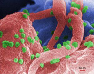 Human Immunodeficiency Virus