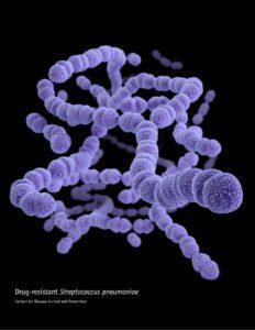 Streptococcus pneumoniae