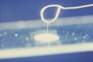 Droplets of sample of suspected colonies of Vibrio cholerae bacteria (Public Health Image Library, CDC, Image ID:3909)