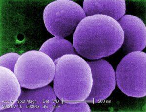 staphylococcus aureus
