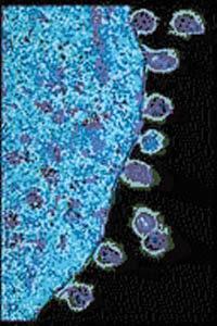 HIV shed from cell