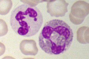 Neutrophil in blood smear