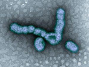 H1N1 influenza virus particles