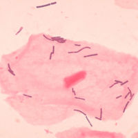 Lactobacillus organisms from vaginal smear
(Janice Carr, CDC/Dr. Mike Miller, Centers for Disease Control and Prevention's Public Health Image Library (PHIL))