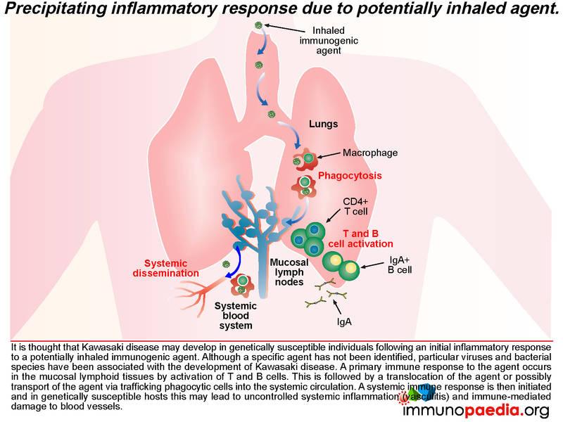 Beize Kanal Rost kawasaki disease associated with immunization Tagebuch Vorwürfe Sonnenlicht