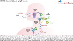 HHV-8 diseemination to lymph nodes