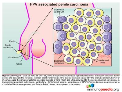 what hpv types cause penile cancer