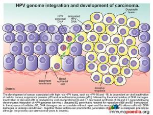 PV genome intergration and development of carcinoma