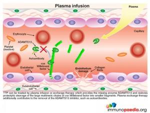 Plasma infusion
