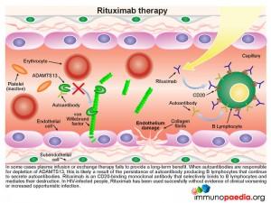 Rituximab therapy