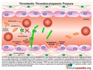 Thrombotic-thrombocytopaenic-purpura