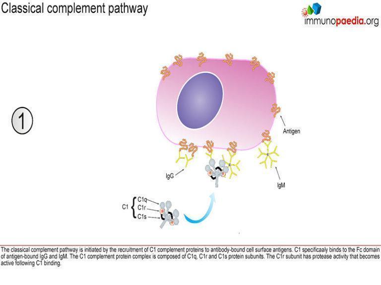 Complement Deficiencies Case Study | Immunopaedia Immunopaedia