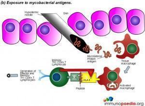 exposure-to-mycobacterial-antigens