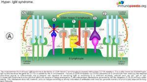 hyper-IgM syndrome_Page_4