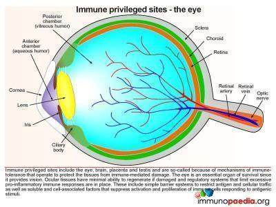Sympathetic ophthalmia Case Study | Immunopaedia Immunopaedia