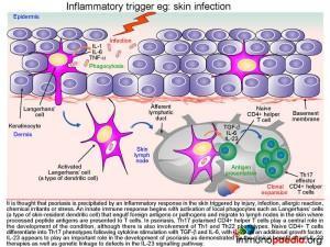 Inflammatory trigger eg skin infection